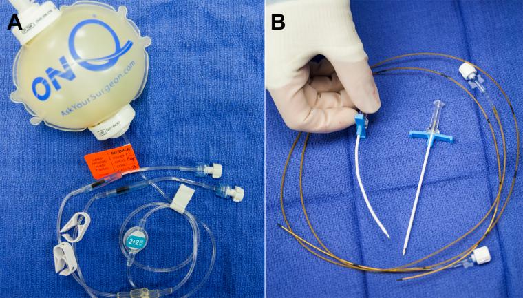 Sonda Çıkarıldıktan Sonra Ağrı Neden Olur?